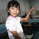 Illustration for article titled Doctors Save Girl's Hand By Grafting It To Her Leg For 3 Months